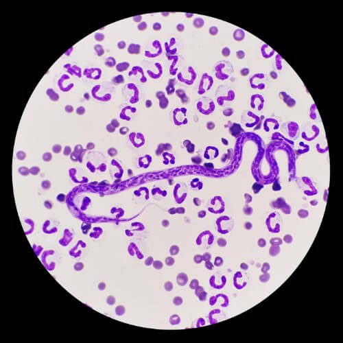 Microscopic image of heartworm - Protecting Your Pet from Heartworm: